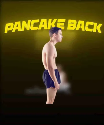 No more Pancake Back
