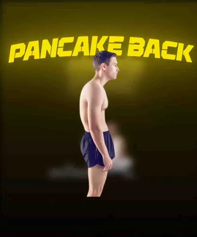 No more Pancake Back